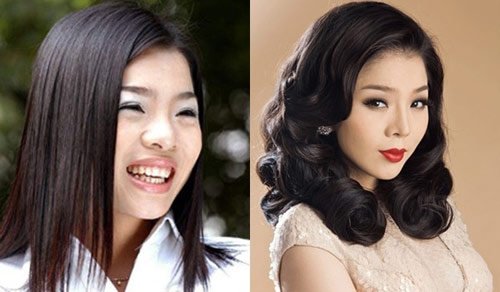 Chỉnh sửa mũi - Bí quyết làm đẹp được nhiều sao Việt lựa chọn 1