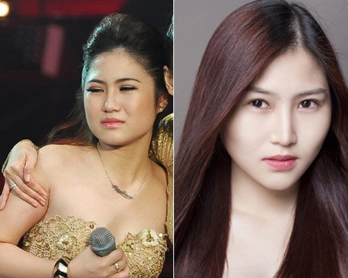 Chỉnh sửa mũi - Bí quyết làm đẹp được nhiều sao Việt lựa chọn 3