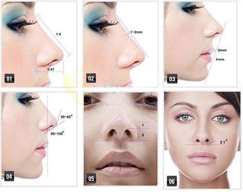 Nâng cao sống mũi khắc phục hoàn toàn mũi tẹt 3
