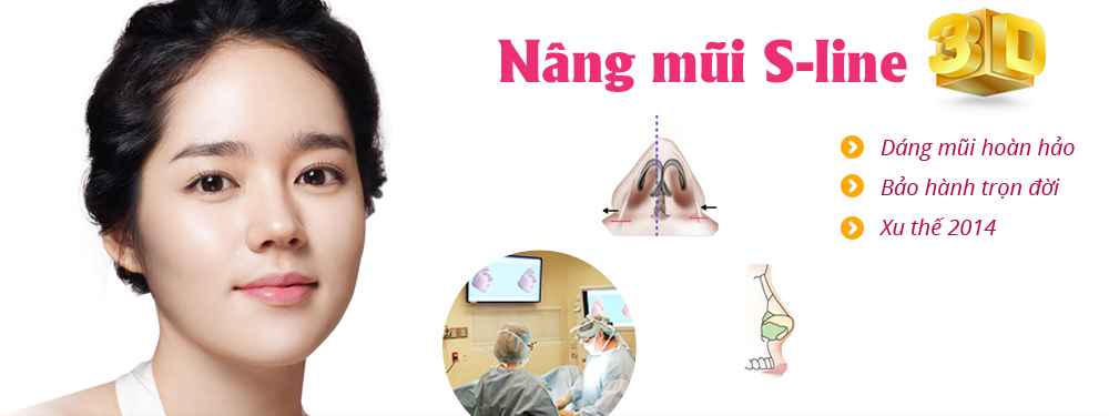 Nâng mũi s line công nghệ Hàn Quốc