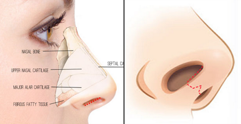 Làm cách nào để mũi cao thanh tú đẹp tự nhiên? 5