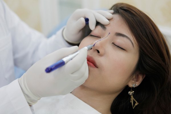 Phẫu thuật chỉnh sửa mũi hếch CAM KẾT an toàn, mũi đẹp tự nhiên 4
