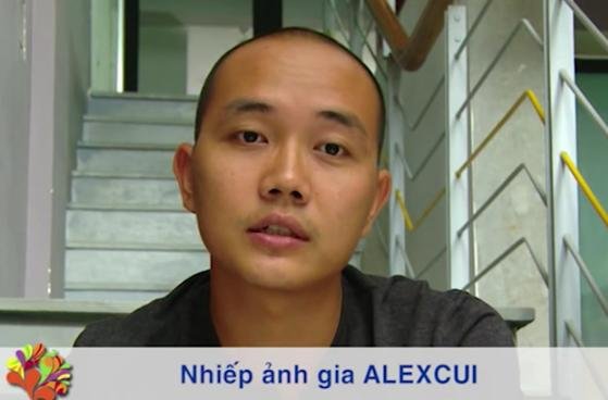 VTV3 - Góc nhìn chưa biết về phẫu thuật nâng mũi S-line 3D 3