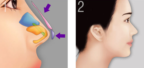Học cách làm mũi cao với những bí quyết đơn giản đến bất ngờ 3