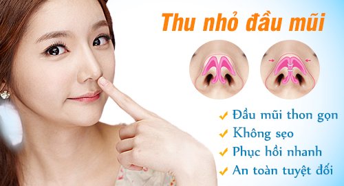 Vì sao phải thực hiện thu nhỏ đầu mũi? 2