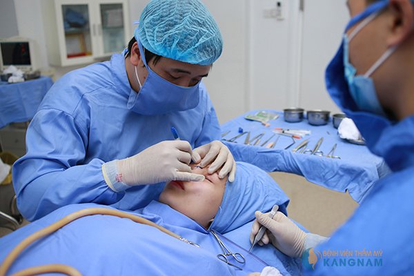 Giá thu nhỏ đầu mũi 3