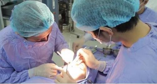 Sửa mũi hếch tạm biệt dáng mũi xấu xí kém duyên 4