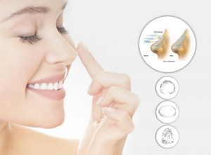 Biến chứng nào có thể gặp phải sau nâng mũi và cách khắc phục?