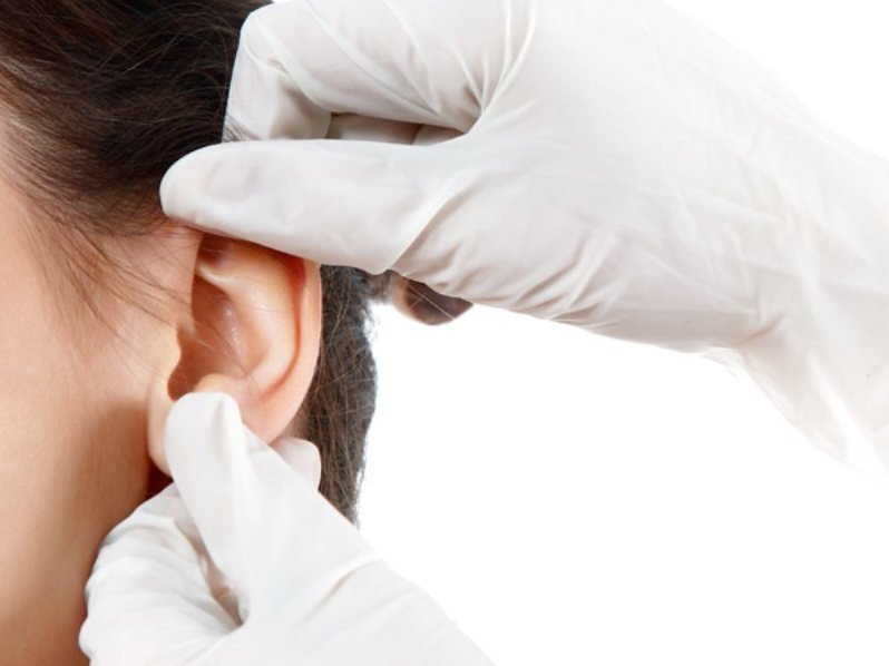 Nên chọn chất liệu nâng mũi nào để không gặp biến chứng? 3