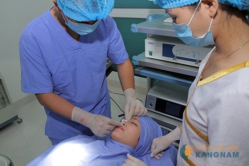 nâng mũi tẹt thành mũi cao 2