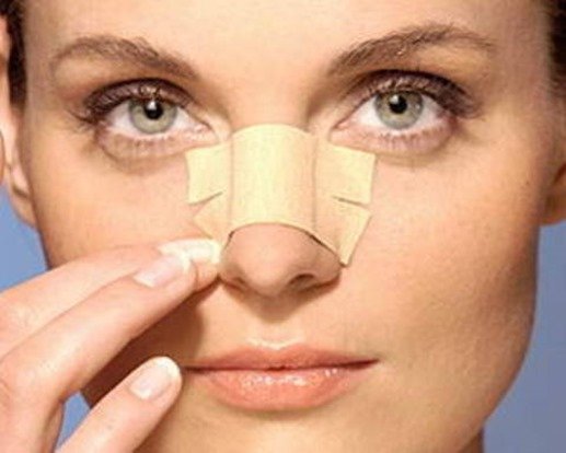 3 lưu ý nên "dắt theo" khi quyết định phẫu thuật thẩm mỹ mũi Hàn Quốc 2