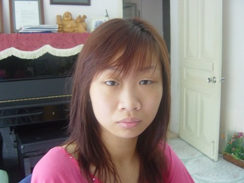 Có cách nào sửa cánh mũi to bè ra hai bên? 1