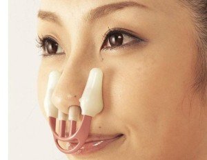 Nâng mũi bằng kẹp – “Nâng tầm” nhan sắc hay “rủi ro” không đáng có?