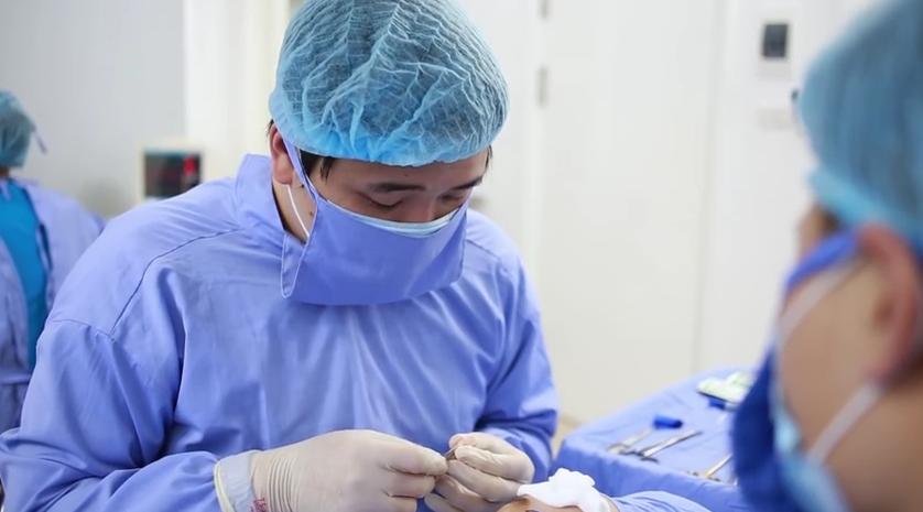 Nâng mũi hoàn toàn bằng sụn tự thân 18