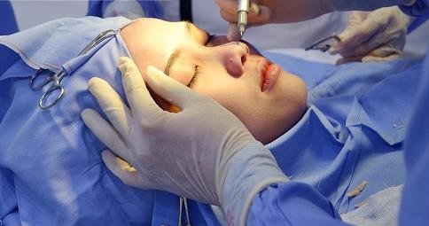 Nâng mũi ở Thái Lan có nên không? 2