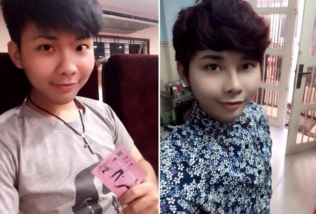 Nâng mũi Kangnam's Perfect Sline - Mũi đẹp toàn diện, vĩnh viễn 5