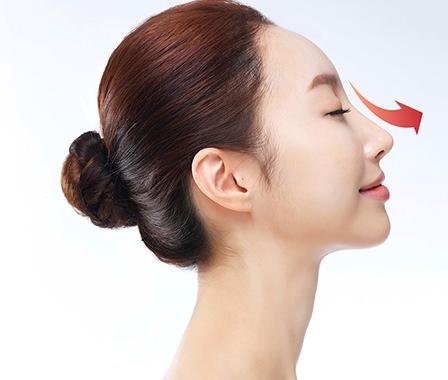 Tất tần tật những dáng mũi xấu khiến phái đẹp phải “tu sửa cấp tốc” 1
