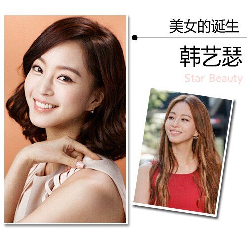 Sao Hàn trước và sau nâng mũi thay đổi như thế nào? 1