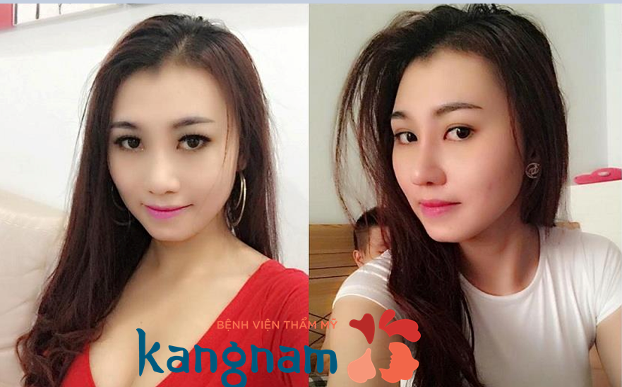 khach-hang-an-na