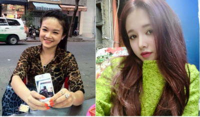 Hiệu quả cắt cánh mũi nội soi cắt cánh mũi nội soi
