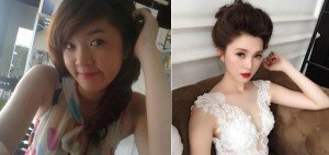 Tư vấn: Cắt cánh mũi giá bao nhiêu tiền?
