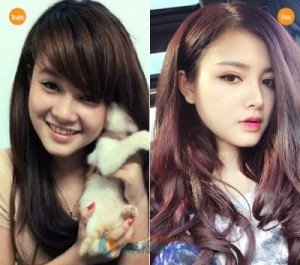 Nâng mũi có ảnh hưởng gì đến sức khoẻ không ?