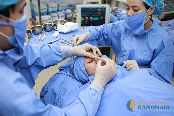 sụn nâng mũi S line 3D 2