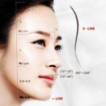 Cận cảnh một ca cấy ghép sụn nâng mũi S line 3D