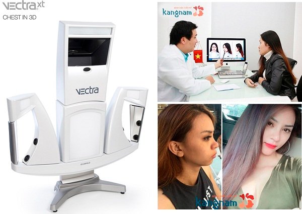 Lệch vách ngăn mũi 3