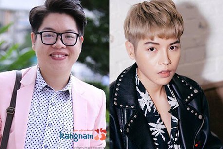 Đức Phúc: "Nhờ sự tư vấn nhiệt tình của các bác sĩ Kangnam mà mũi Phúc rất nhanh lành, cũng không hề nhìn thấy sẹo dù soi kỹ cỡ nào" thu gọn cánh mũi có để lại sẹo không 1