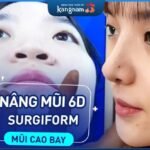 Kinh nghiệm nâng mũi 6D Sụn Surgiform giúp mũi tự nhiên, không sẹo