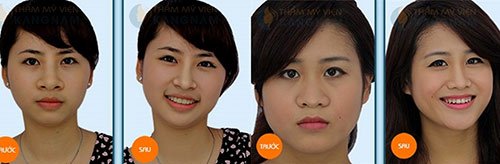 thu-gon-canh-mui-ho-bien-nho-xinh-sau-30-phut-off-20-4