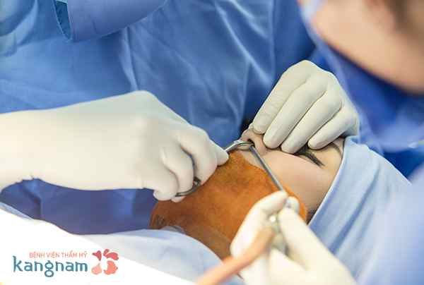Nâng mũi đẹp: Chuẩn Hàn Quốc - Giá "Việt Nam" 2